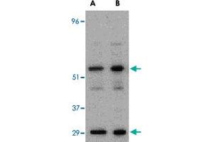Western blot analysis of PDCD4 in A-20 cell lysate with PDCD4 polyclonal antibody  at (A) 0.