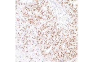 anti-Actin-Like 6A (BAF53A) (AA 25-75) antibody