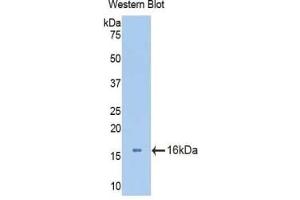 Detection of Recombinant AGC, Mouse using Polyclonal Antibody to Aggrecan (AGC) (Aggrecan 抗体  (AA 34-147))