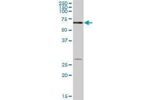 Western Blotting (WB) image for anti-Dyskeratosis Congenita 1, Dyskerin (DKC1) (AA 1-514) antibody (ABIN514989)