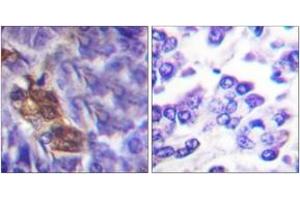 Immunohistochemistry analysis of paraffin-embedded human pancreas tissue, using MSK1 (Ab-360) Antibody. (MSK1 抗体  (AA 331-380))