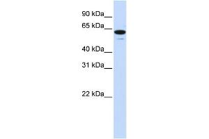 WB Suggested Anti-ZNF655 Antibody Titration:  0. (ZNF655 抗体  (Middle Region))