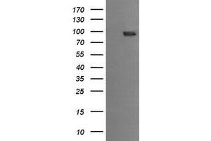 Image no. 1 for anti-Phosphoinositide-3-Kinase, Regulatory Subunit 5 (PIK3R5) antibody (ABIN1500218) (PIK3R5 抗体)