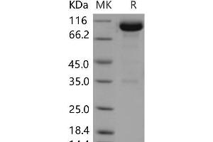 Western Blotting (WB) image for Opioid Binding Protein/cell Adhesion Molecule-Like (OPCML) (Active) protein (Fc Tag) (ABIN7320095)