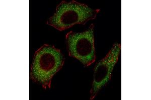 Fluorescent image of  cell stained with NFKBp65 Antibody (C-term) (ABIN1537682 and ABIN2849713). (NF-kB p65 抗体  (C-Term))