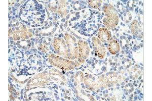 Image no. 1 for anti-Frizzled Family Receptor 7 (FZD7) (C-Term) antibody (ABIN6736223) (FZD7 抗体  (C-Term))