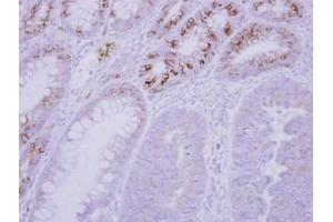 Image no. 1 for anti-Glucokinase (Hexokinase 4) Regulator (GCKR) (AA 1-214) antibody (ABIN1501890) (GCKR 抗体  (AA 1-214))