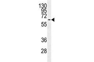 MAPK15 antibody western blot analysis in MCF-7 lysate. (MAPK15 抗体)