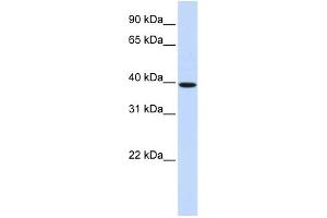 WB Suggested Anti-HOXB3 Antibody Titration: 0. (HOXB3 抗体  (N-Term))