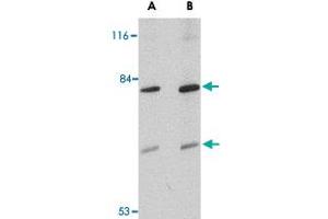 Western blot analysis of TMC8 in Jurkat cell lysate with TMC8 polyclonal antibody  at (A) 1 and (B) 2 ug/mL . (TMC8 抗体  (Internal Region))