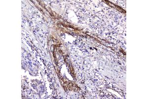 IHC analysis of Serum Amyloid P using anti-Serum Amyloid P antibody . (APCS 抗体  (AA 20-220))