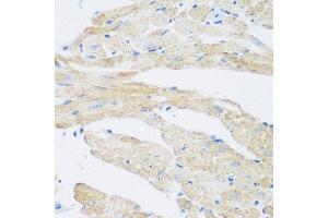 Immunohistochemistry of paraffin-embedded mouse heart using NAT8B antibody at dilution of 1:200 (40x lens). (NAT8B 抗体)