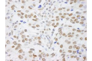 anti-Scaffold Attachment Factor B (SAFB) (C-Term) antibody