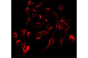 ABIN6267299 staining HepG2 by IF/ICC. (Integrin beta 3 抗体  (pTyr773))
