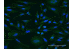 Immunofluorescence of monoclonal antibody to IGDCC4 on HeLa cell. (IGDCC4 抗体  (AA 1152-1250))