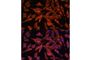 Immunofluorescence analysis of L929 cells using MT-ND1 Polyclonal Antibody (ABIN7268598) at dilution of 1:100 (40x lens). (MT-ND1 抗体)