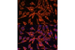 Immunofluorescence analysis of L929 cells using MT-ND1 Polyclonal Antibody (ABIN7268598) at dilution of 1:100 (40x lens).