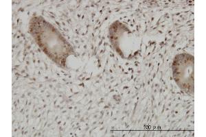 Immunoperoxidase of monoclonal antibody to UHRF1 on formalin-fixed paraffin-embedded human endometrium. (UHRF1 抗体  (AA 694-793))