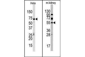 Image no. 1 for anti-Jumonji Domain Containing 4 (JMJD4) (C-Term) antibody (ABIN356562) (JMJD4 抗体  (C-Term))