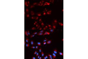 Immunofluorescence analysis of U2OS cells using CFP antibody (ABIN5973127). (CFP 抗体)