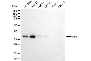 Western blotting analysis using PPT1 antibody (ABIN7799730). (PPT1 抗体)