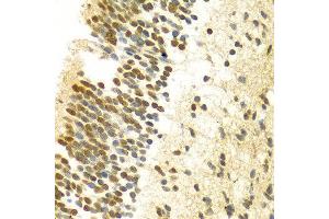 Immunohistochemistry of paraffin-embedded Human embryo brain using MYSM1 antibody at dilution of 1:100 (x400 lens). (MYSM1 抗体  (C-Term))