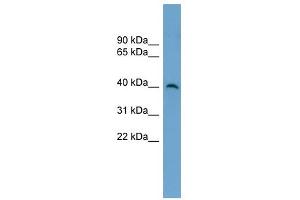 SUV39H2 antibody used at 1 ug/ml to detect target protein.