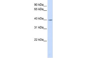 WB Suggested Anti-LRRC28 Antibody Titration: 0. (LRRC28 抗体  (C-Term))