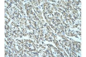 Rabbit Anti-FGD1 Antibody Catalog Number: ARP31673  Paraffin Embedded Tissue: Human cardiac cell  Cellular Data: Epithelial cells of renal tubule Antibody Concentration:  4. (FGD1 抗体  (C-Term))