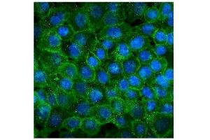IF analysis of P cadherin using anti-P cadherin antibody (ABIN7599888). (P-Cadherin 抗体  (AA 126-336))