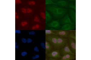 PRCC Mouse Monoclonal Antibody staining Hela cells by IF/ICC. (PRCC 抗体)
