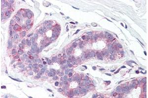 Anti-SLC39A6 antibody  ABIN960810 IHC staining of human breast. (SLC39A6 抗体  (N-Term))
