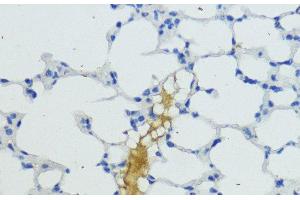 Immunohistochemistry of paraffin-embedded Mouse lung using KLKB1 Polyclonal Antibody at dilution of 1:200 (40x lens). (KLKB1 抗体)