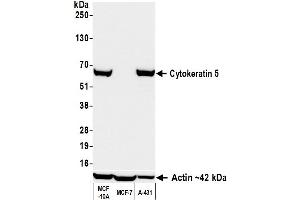 Western Blotting (WB) image for anti-Keratin 5 (KRT5) (C-Term) antibody (ABIN7795755) (Recombinant Cytokeratin 5 抗体  (C-Term))