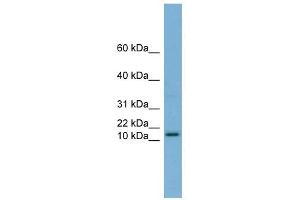 HRK antibody used at 1 ug/ml to detect target protein. (HRK 抗体)