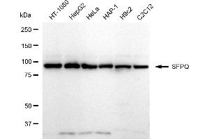 Western blotting analysis using SFPQ antibody (ABIN7800427).