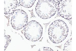 Immunohistochemistry of paraffin-embedded Mouse testis using Bcl9 antibody (ABIN6129972, ABIN6137514, ABIN6137515 and ABIN6222543) at dilution of 1:100 (20x lens). (BCL9 抗体)