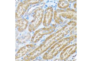 Immunohistochemistry (IHC) image for anti-Coatomer Protein Complex, Subunit alpha (COPA) antibody (ABIN7266423)