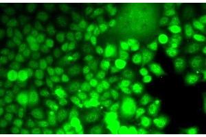 Immunofluorescence analysis of MCF7 cells using ALOX15B Polyclonal Antibody (ALOX15B 抗体)