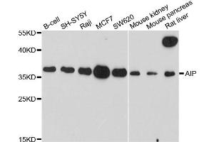Western blot analysis of extracts of various cell lines, using AIP antibody. (AIP 抗体)