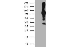 Western Blotting (WB) image for anti-phosphofructokinase, Platelet (PFKP) antibody (ABIN1500163) (PFKP 抗体)