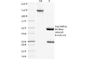 SDS-PAGE Analysis Purified MUC16 Mouse Monoclonal Antibody (MUC16/1860). (MUC16 抗体)
