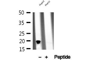 Western blot analysis of extracts of HepG2 cells, using NDUFB11 antibody. (NDUFB11 抗体  (N-Term))