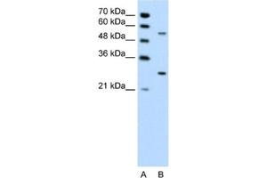 Western Blotting (WB) image for anti-3-phosphoinositide Dependent Protein Kinase-1 (PDPK1) antibody (ABIN2460187) (PDPK1 抗体)