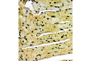 Anti-Aryl hydrocarbon Receptor antibody,  IHC(P) IHC(P): Mouse Cardiac Muscle Tissue (Aryl Hydrocarbon Receptor 抗体  (C-Term))