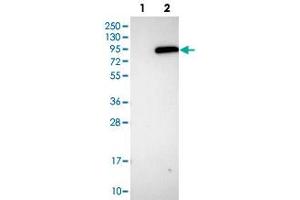 Western blot analysis of HEK293T cell lysate using PLA2G6 polyclonal antibody . (PLA2G6 抗体)