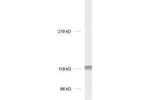 dilution: 1 : 1000, sample: rat brain homogenate (GRIK2 抗体  (C-Term))