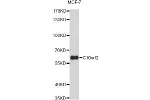 Western blot analysis of extracts of MCF-7 cells, using C10orf2 Antibody (ABIN5973049) at 1/1000 dilution. (C10orf2 抗体)