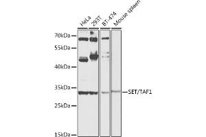 Western blot analysis of extracts of various cell lines, using SET/T antibody (ABIN6131352, ABIN6147630, ABIN6147633 and ABIN6216166) at 1:1000 dilution. (SET/TAF-I 抗体  (AA 146-277))