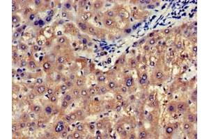 Immunohistochemistry of paraffin-embedded human liver tissue using ABIN7146747 at dilution of 1:100 (NOS1AP 抗体  (C-Term))
